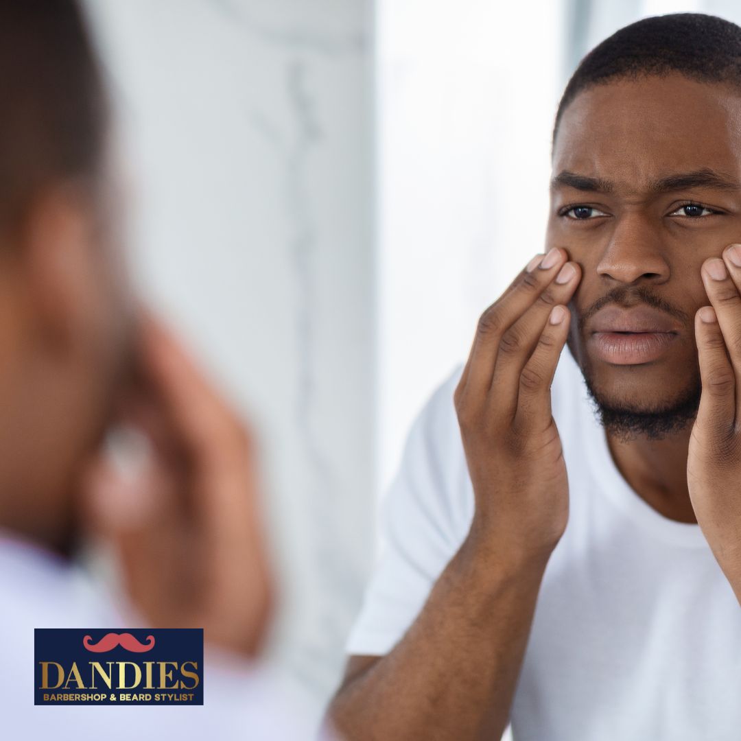 What facial treatment prevents acne?
